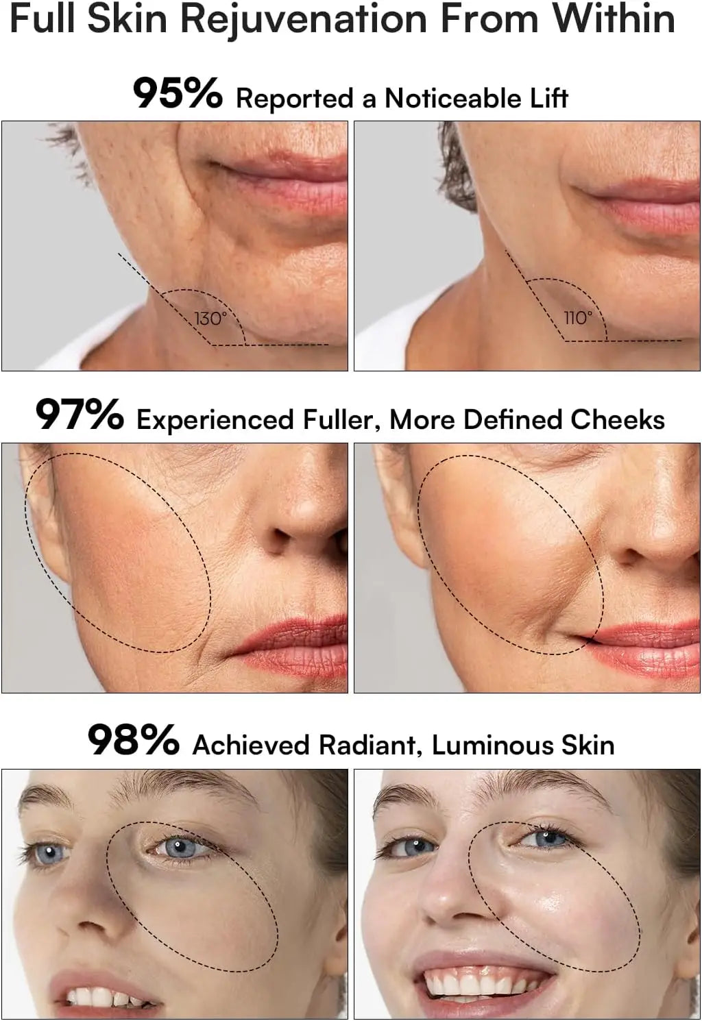 3-in-1 Skin Tightening Device with Red Light Therapy for Face and Neck, True Beauty Glow Facial Massager